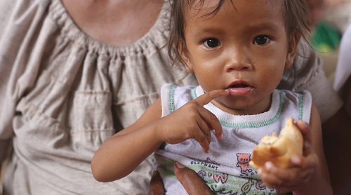 Undernourished children are more prone to COVID-19
